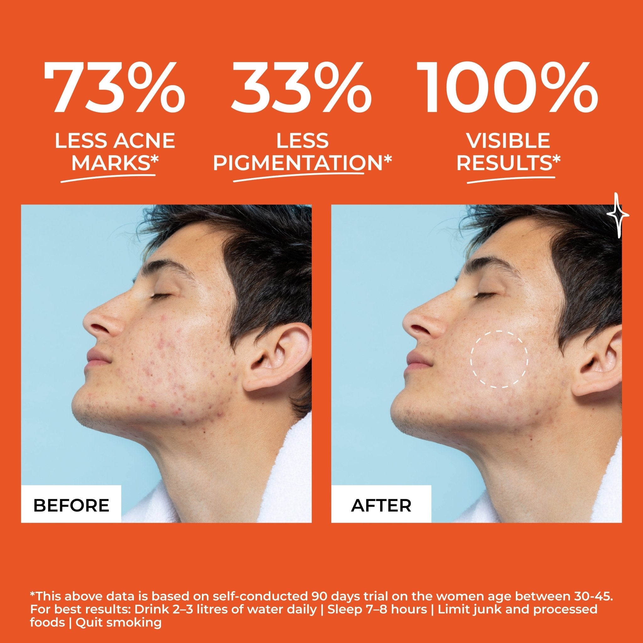 Be Odd Beyond Skin Acne Skin Supplement - 30 counts - Health N Wellness Shop